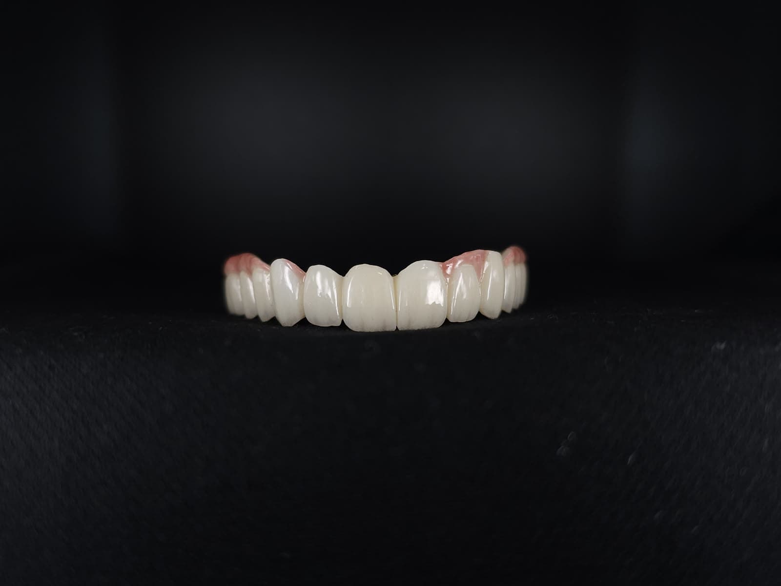 Anterior Zirconia Bridge