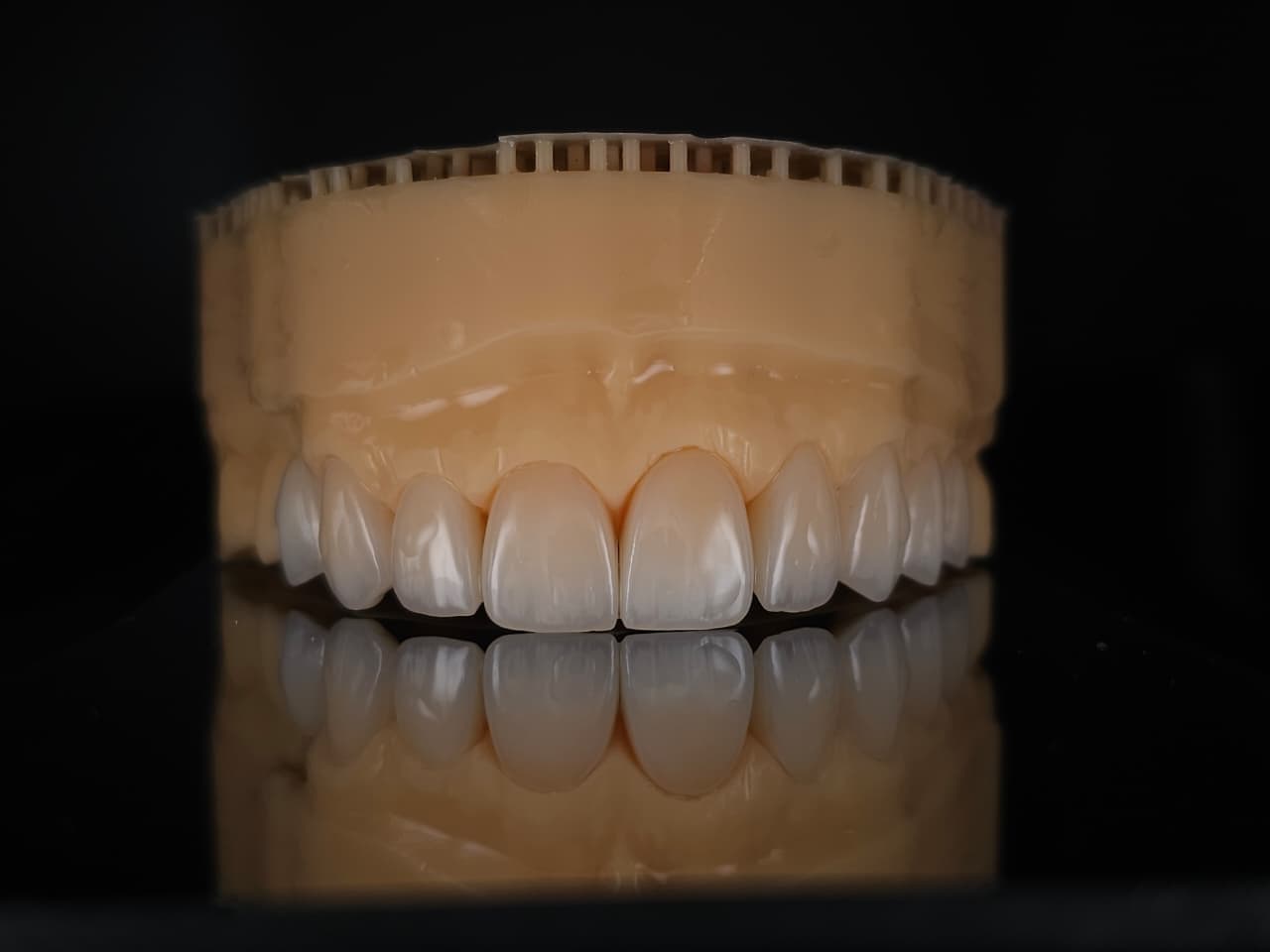Anterior Restoration, Bisque Stage